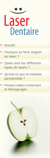 Laser Dentaire - tlchargez le lecteur flash